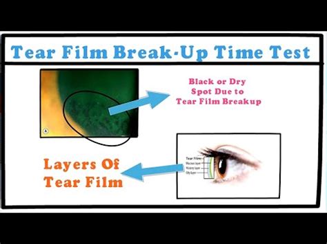 tear break-up time tbut test|tear film breakdown time.